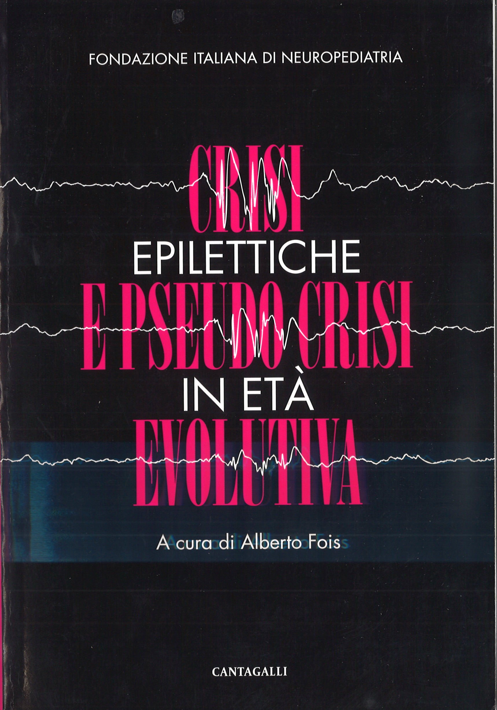 F. ITALIANA DI NEUROPEDIATRIA – CRISI epilettiche E PSEUDO CRISI in età EVOLUTIVA